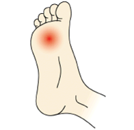 Plantar Fasciitis,Pes Planus,Mallet Toe,High Arched Feet,Heel Spur,Heel Pain,Hammer Toe,Hallux Valgus,Foot Pain,Foot Hard Skin,Foot Conditions,Foot Callous,Flat Feet,Fallen Arches,Diabetic Foot,Contracted Toe,Claw Toe,Bunions Hard Skin,Bunions Callous,Bunion Pain,Ball Of Foot Pain,Back Pain